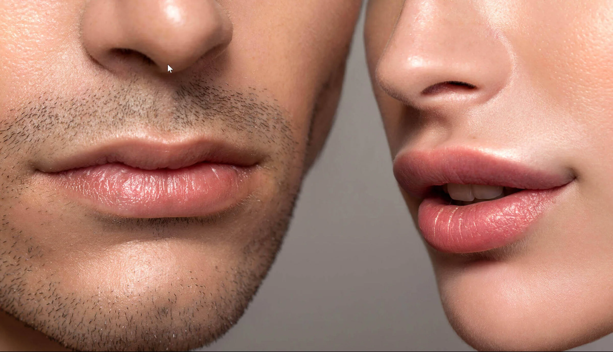 LipLase laser lip reshaping and augmentation