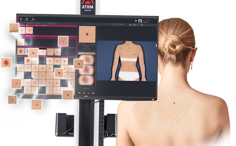 Skin Check