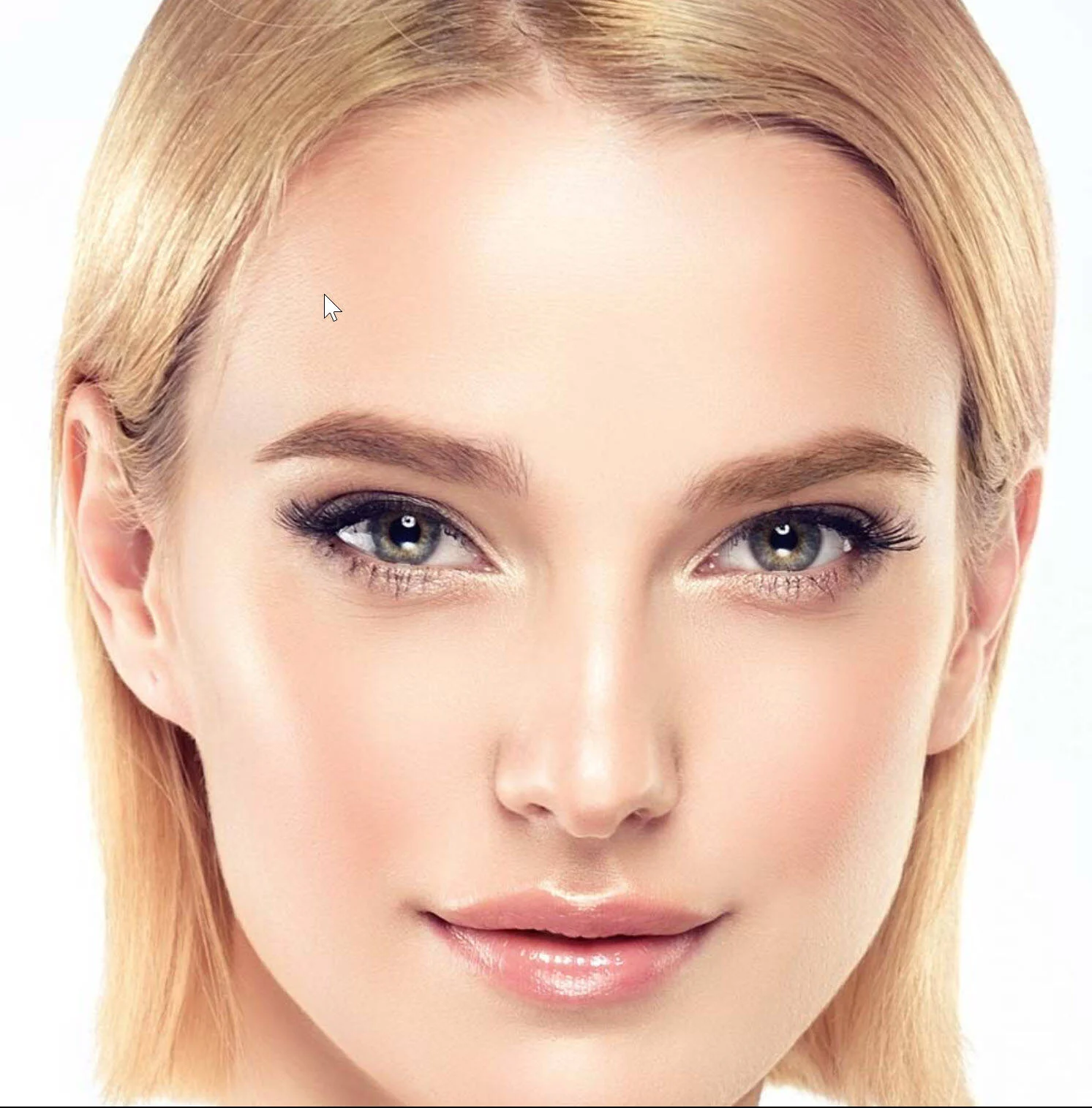 VectorLift Non-Invasive Laser Eyebrow Lifting