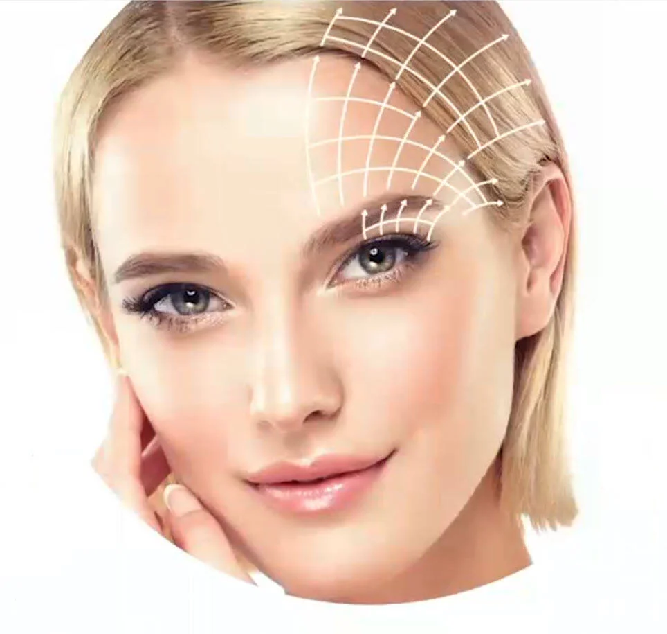 Eyebrow lift treatment area mapped on a patient's face