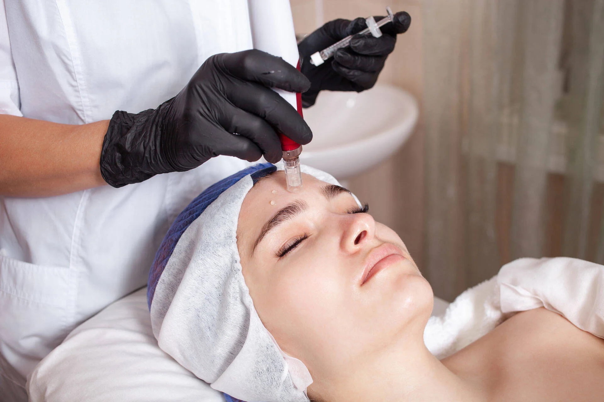 Microneedling treatment being performed on a patient's face