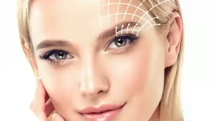 Browlift_1735719086